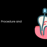 Root Canal: Procedure and Treatment