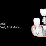 Dental Implants: Procedure, Cost, And More