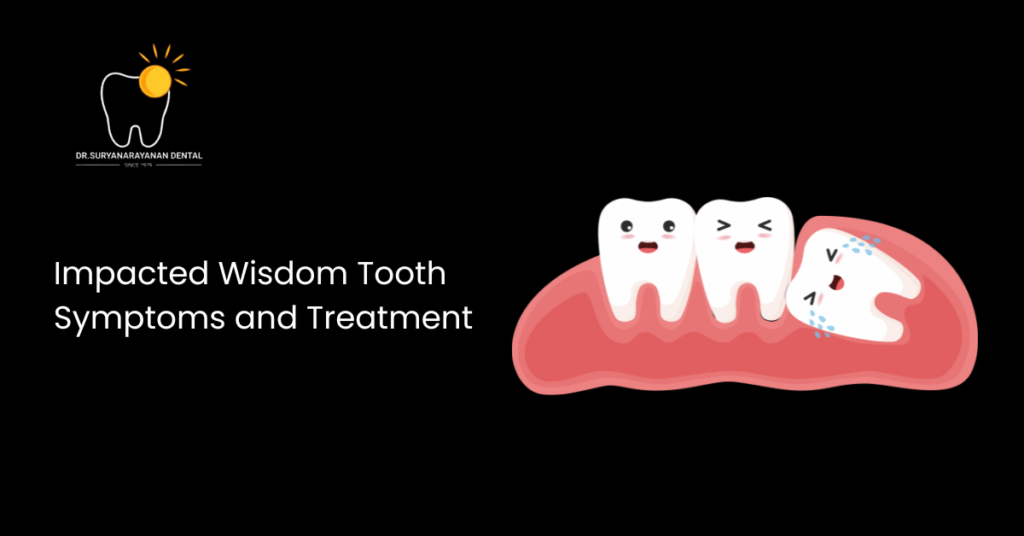 Impacted Wisdom Tooth Symptoms and Treatment