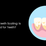 Benefits Of Teeth Scaling: Is Scaling Good for Teeth?