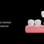 Diabetes and dental implant procedure