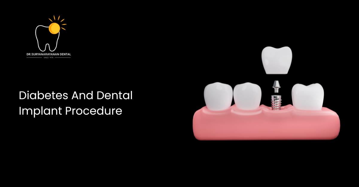 Diabetes and dental implant procedure