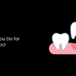 What Can You Do for Missing Teeth