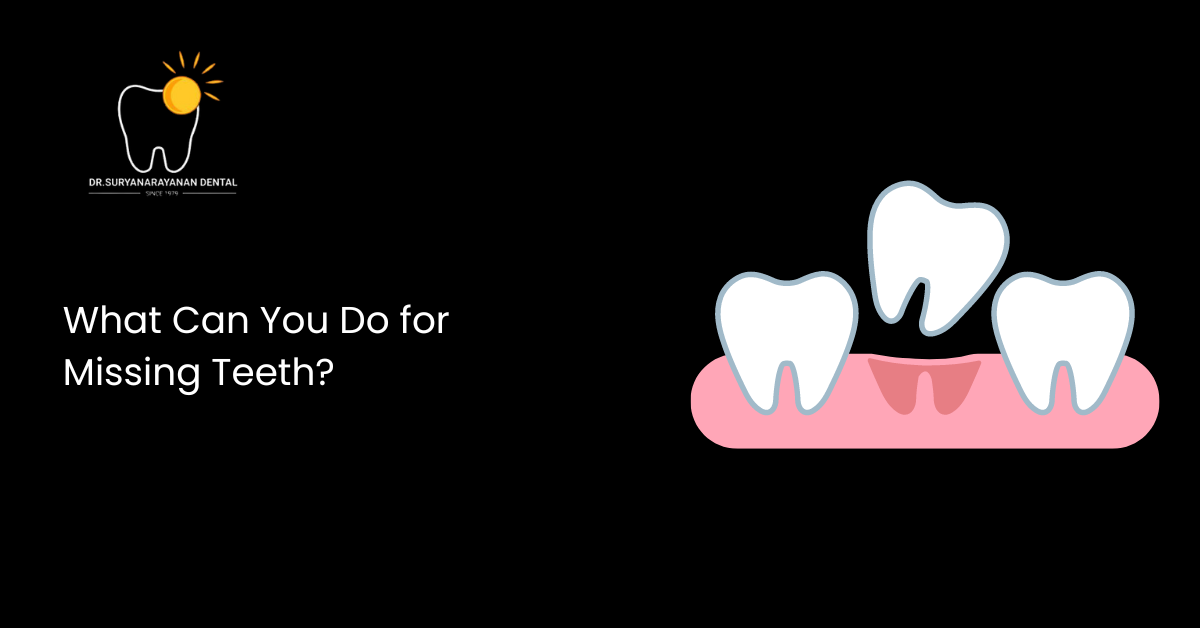 What Can You Do for Missing Teeth