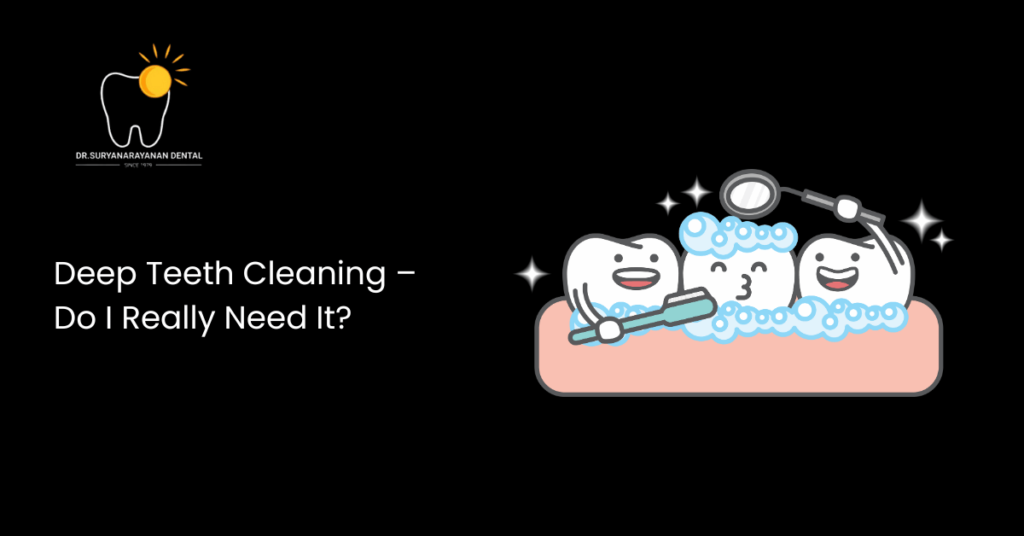 Deep Teeth Cleaning – Do I Really Need It?