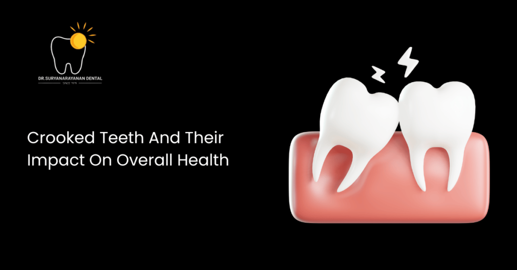 Crooked Teeth, Overall Health