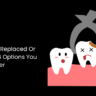 Want Tooth Replaced Or Removed? 4 Options You Can Consider