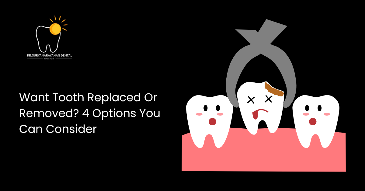 Want Tooth Replaced Or Removed? 4 Options You Can Consider