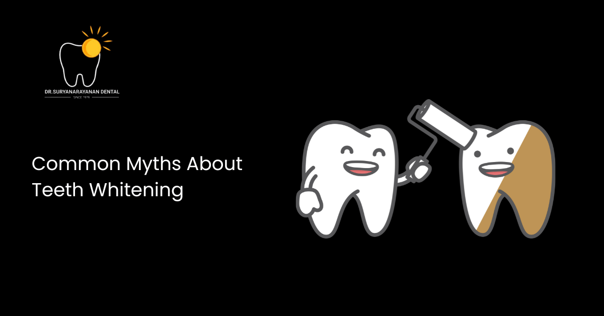 Common Myths About Teeth Whitening