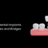 Benefits of Dental Implants Over Dentures and Bridges