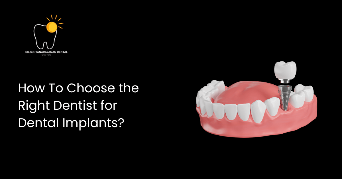 How To Choose the Right Dentist for Dental Implants?