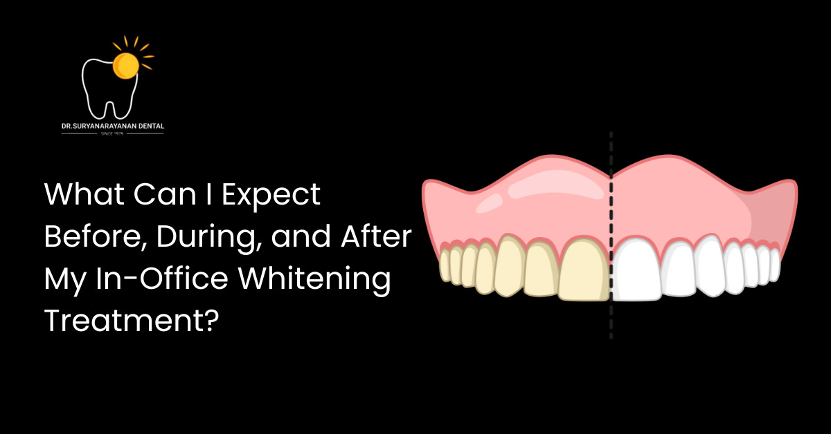 What Can I Expect Before, During, and After My In-Office Whitening Treatment?