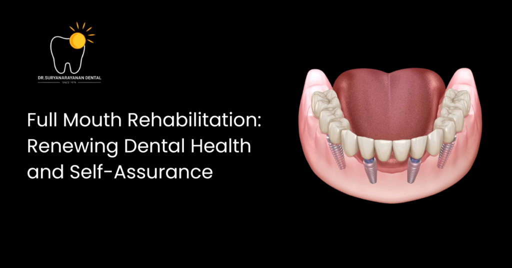 Full Mouth Rehabilitation: Renewing Dental Health and Self-Assurance