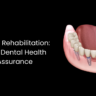 Full Mouth Rehabilitation: Renewing Dental Health and Self-Assurance