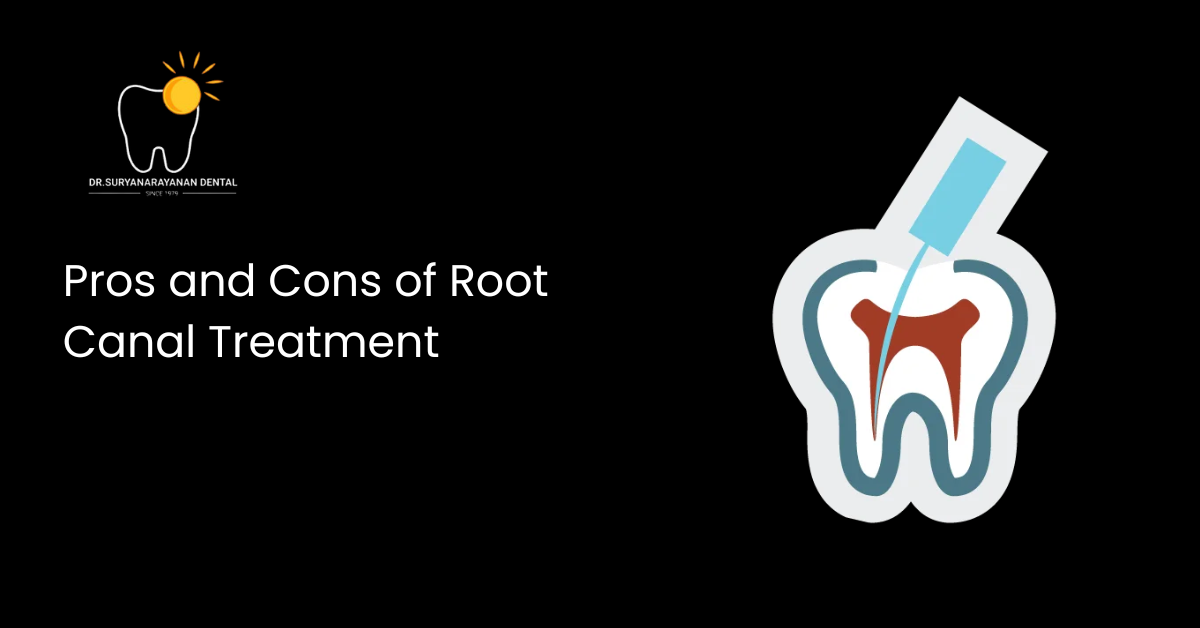 Root Canal Treatment